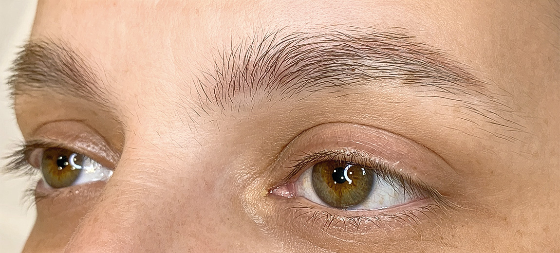 Sobrancelhas - Antes - 1