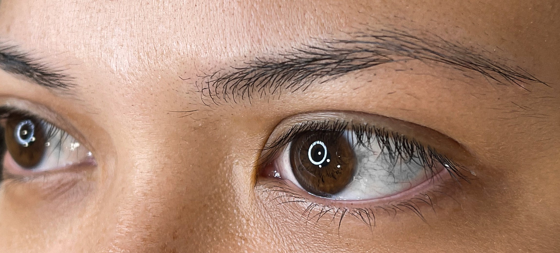 Sobrancelhas - Antes - 2