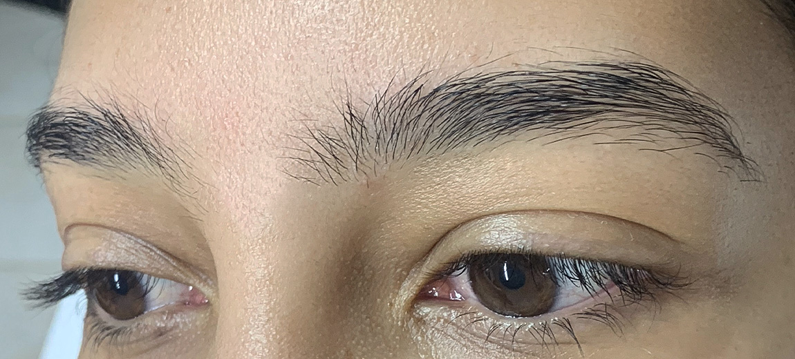 Sobrancelhas - Antes - 3
